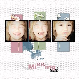 Missing teeth