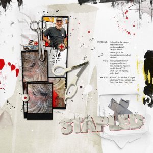 Stapled