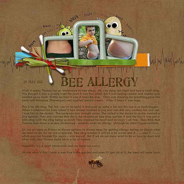 Bee Allergy