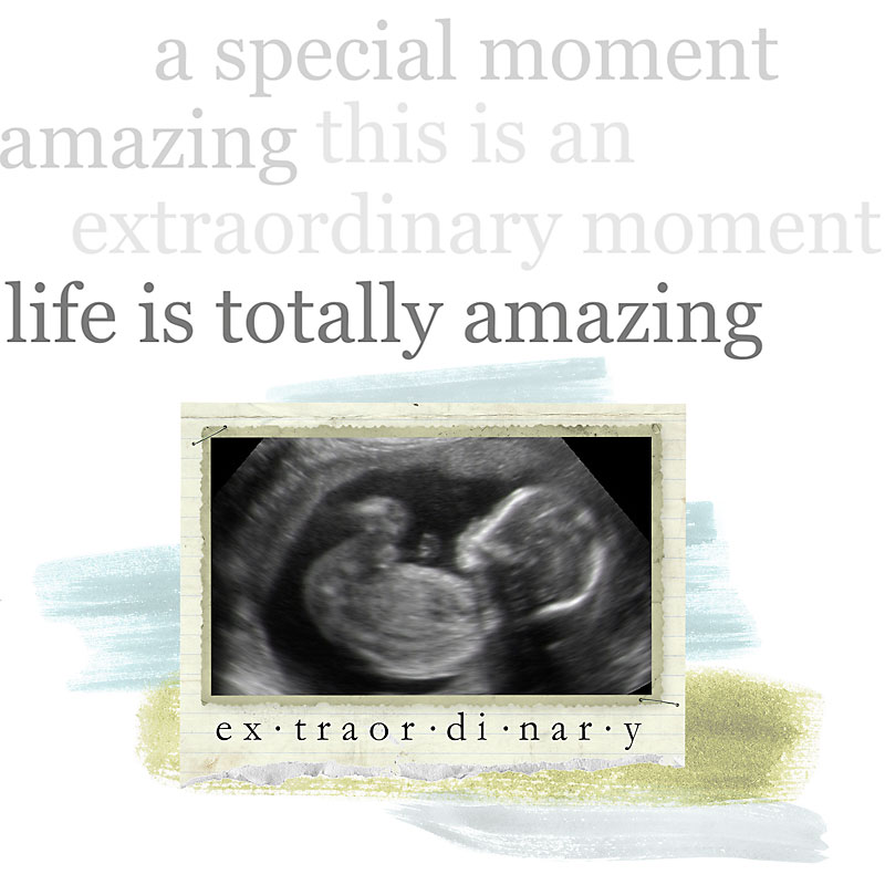 extraordinary ultrasound